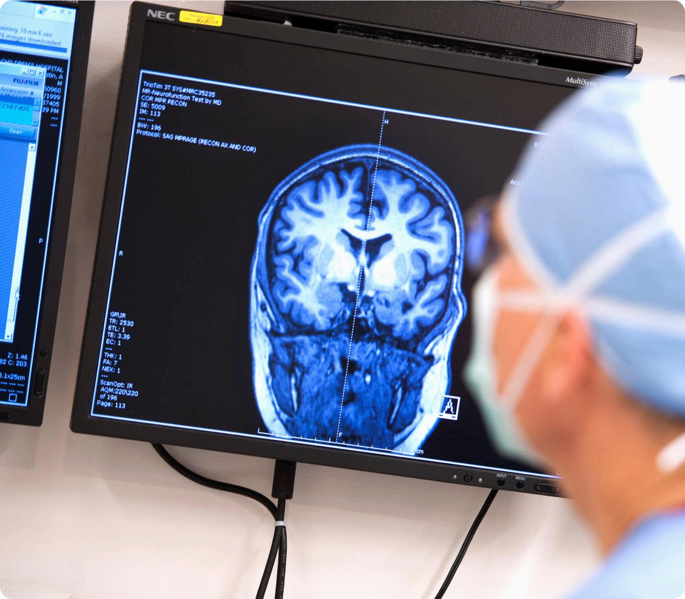 Методы лечения эпилепсии Методы лечения эпилепсии